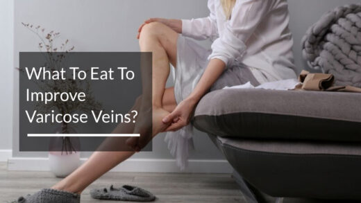 What To Eat To Improve Varicose Veins